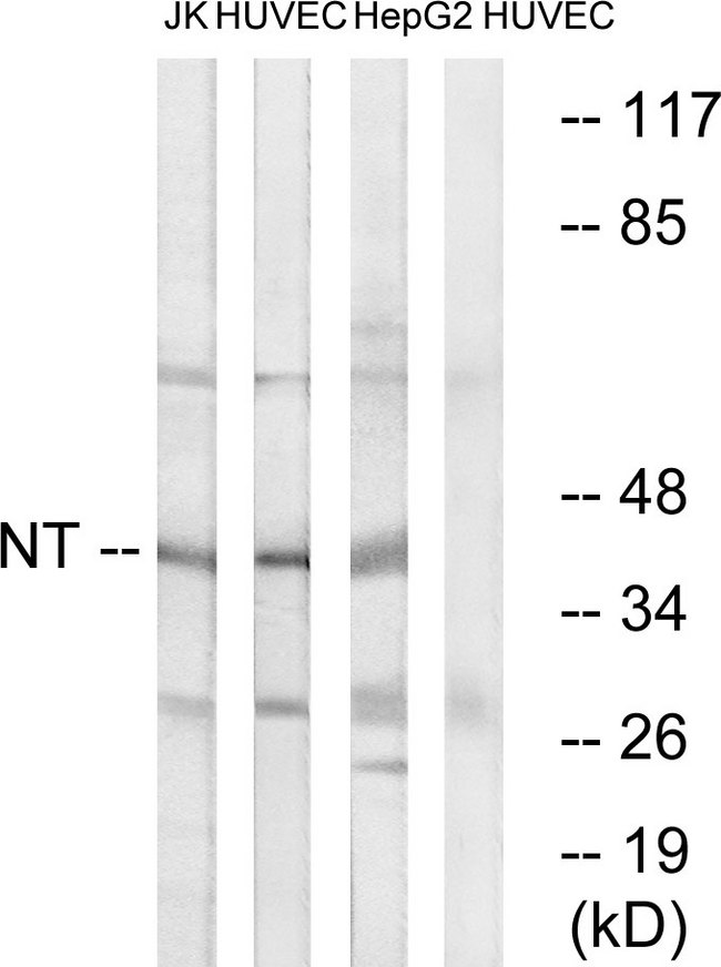 NTM / Neurotrimin Antibody - Western blot analysis of lysates from HUVEC, HepG2, and Jurkat cells, using NT Antibody. The lane on the right is blocked with the synthesized peptide.