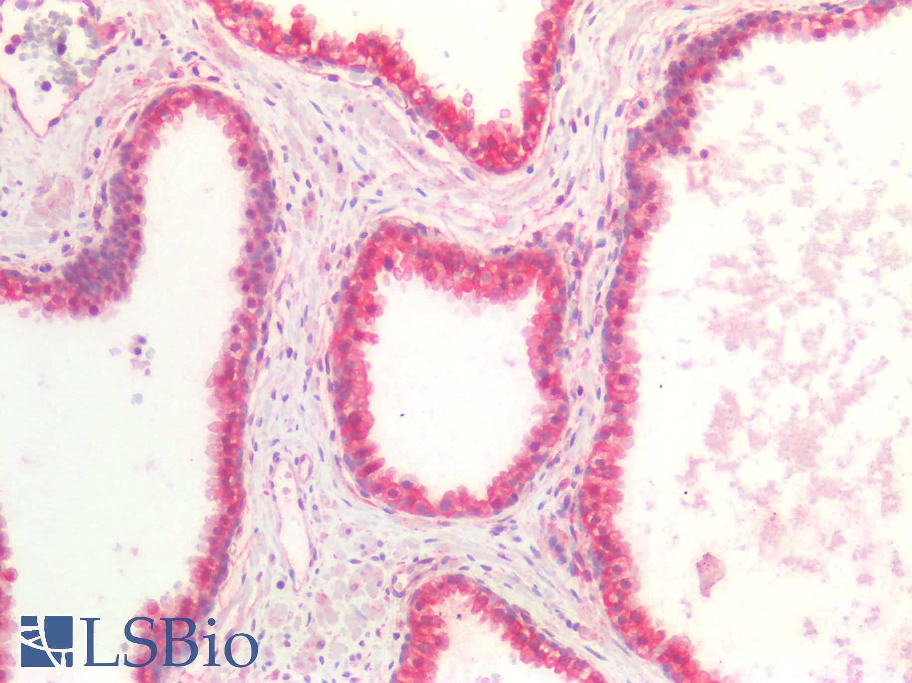 NTN1 / Netrin 1 Antibody - Human Prostate: Formalin-Fixed, Paraffin-Embedded (FFPE)