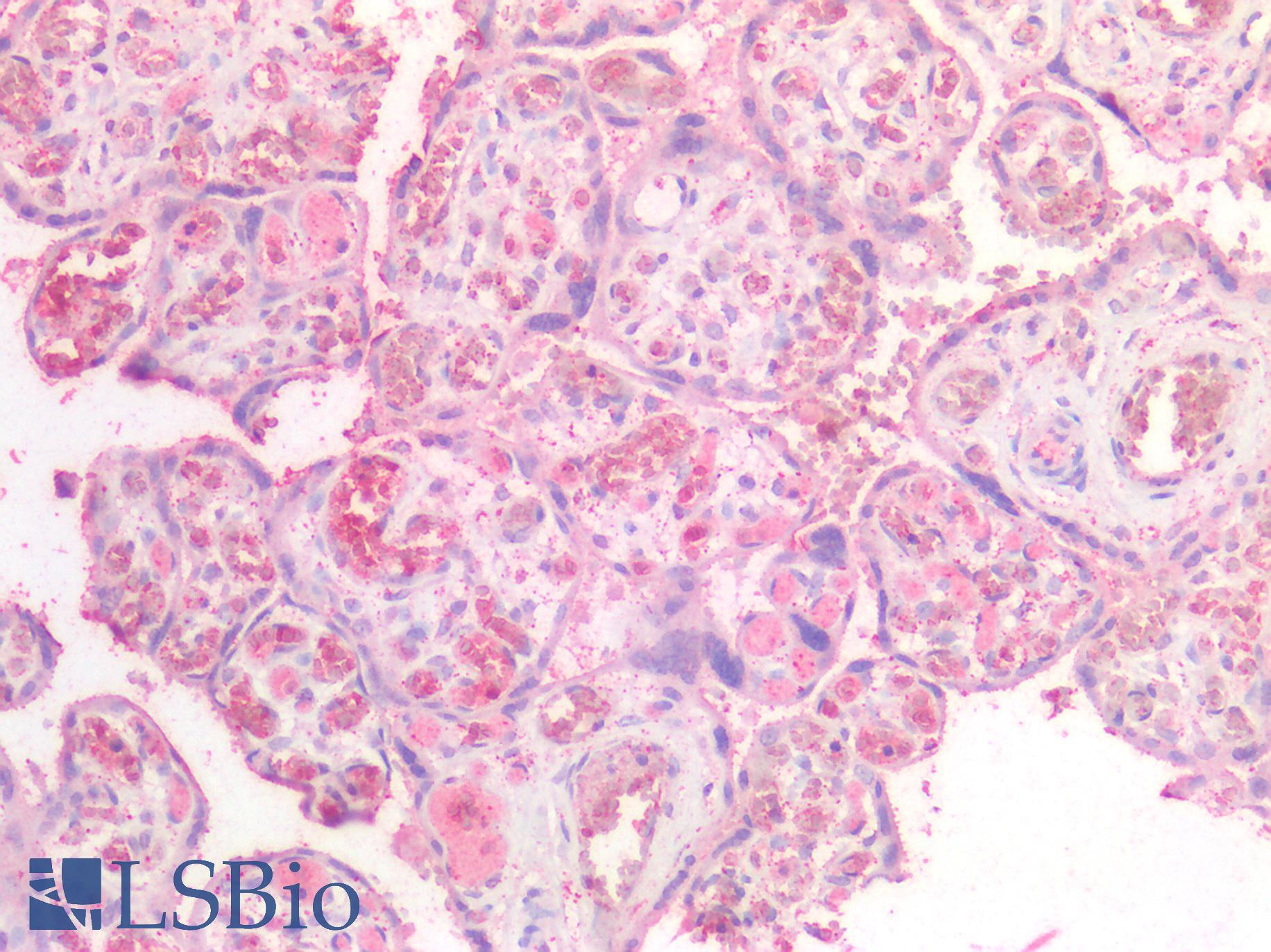 NTN1 / Netrin 1 Antibody - Human Placenta: Formalin-Fixed, Paraffin-Embedded (FFPE)