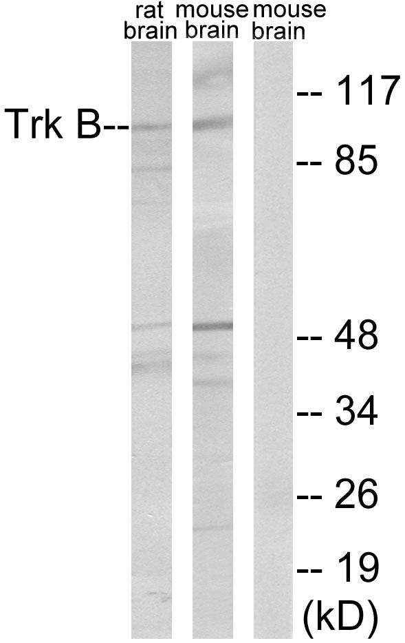 NTRK2 / TRKB Antibody - Western blot analysis of lysates from rat brain and mouse brain, treated with PBS 60', using Trk B Antibody. The lane on the right is blocked with the synthesized peptide.