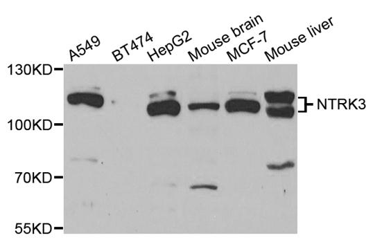 NTRK3 / TRKC Antibody - Western blot analysis of extracts of various cell lines, using NTRK3 antibody.