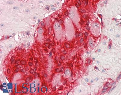 NUCB1 / Nucleobindin Antibody - Human Small Intestine, Myenteric Plexus: Formalin-Fixed, Paraffin-Embedded (FFPE)
