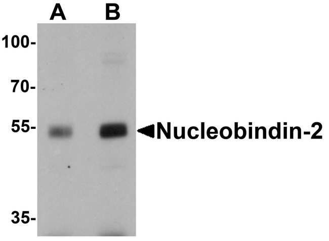 NUCB2 / Nucleobindin 2 Antibody - Western blot analysis of Nucleobindin-2 in rat brain tissue lysate with Nucleobindin-2 antibody at (A) 0.5 and (B) 1 ug/ml.