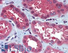 NUDT21 Antibody - Human Kidney: Formalin-Fixed, Paraffin-Embedded (FFPE)