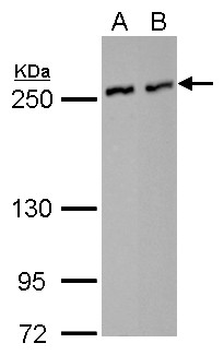 NUMA1 / NUMA Antibody - NuMA antibody [N1], N-term detects NUMA1 protein by Western blot analysis. A. 30 ug HeLa whole cell lysate/extract. B. 30 ug A375 whole cell lysate/extract. 5 % SDS-PAGE. NuMA antibody [N1], N-term dilution:1:1000