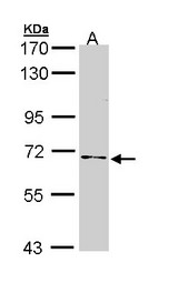 NUMB Antibody - Sample (30 ug of whole cell lysate). A: A431. 7.5% SDS PAGE. NUMB antibody diluted at 1:1000. 