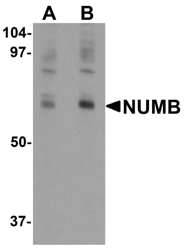 NUMB Antibody - Western blot analysis of NUMB in mouse lung tissue lysate with NUMB antibody at (A) 0.25 and (B) 0.5 ug/ml.