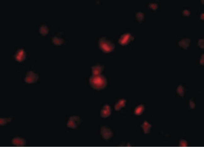 NUP107 Antibody - Immunofluorescence of NUP107 in A549 cells with NUP107 antibody at 10 ug/ml.