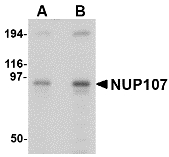 NUP107 Antibody - Western blot of NUP107 in A549 cell lysate with NUP107 antibody at (A) 1 and (B) 2 ug/ml.