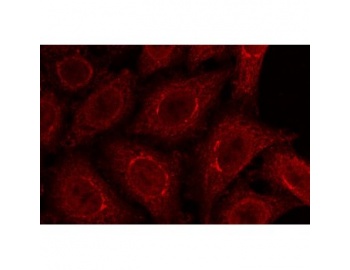 NUP210 / gp210 Antibody - Methanol/acetone fixed HeLa cells stained with rabbit anti gp210 
