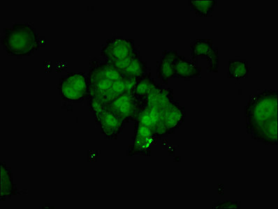 NUP210 / gp210 Antibody - Immunofluorescent analysis of MCF-7 cells using NUP210 Antibody at dilution of 1:100 and Alexa Fluor 488-congugated AffiniPure Goat Anti-Rabbit IgG(H+L)