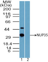 NUP35 / NUP53 Antibody - Western blot of NUP35 in human liver lysate in the 1) absence and 2) presence of immunizing peptide using NUP35 / NUP53 Antibody at 1.0 ug/ml. Goat anti-rabbit Ig HRP secondary antibody, and PicoTect ECL substrate solution, were used for this test.