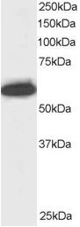 NUP50 Antibody - Antibody staining (0.5 ug/ml) of Jurkat lysate (RIPA buffer, 30 ug total protein per lane). Primary incubated for 1 hour. Detected by Western blot of chemiluminescence.
