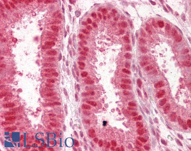 NUP50 Antibody - Anti-NUP50 antibody IHC of human uterus. Immunohistochemistry of formalin-fixed, paraffin-embedded tissue after heat-induced antigen retrieval. Antibody concentration 2.5 ug/ml.