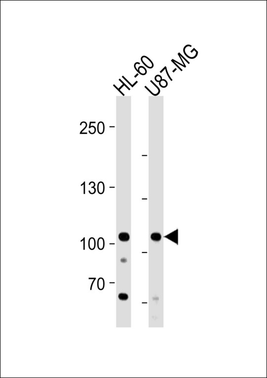 NXP2 / MORC3 Antibody - MORC3 Antibody western blot of HL-60 and U87-MG cell line lysates (35 ug/lane). The MORC3 antibody detected the MORC3 protein (arrow).