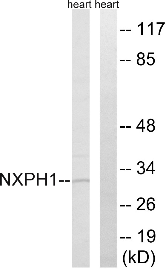 NXPH1 Antibody - Western blot analysis of lysates from rat heart cells, using NXPH1 Antibody. The lane on the right is blocked with the synthesized peptide.