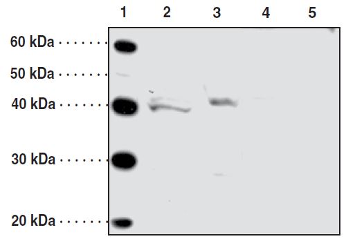 O3FAR1 / GPR120 Antibody - Western blot with GPR120 antibody. Lane 1: MW markers, Lane 2: LoVo cell lysate (20 ug), Lane 3: PC3 cell lysate (40 ug), Lane 4: LoVo cell lysate (20 ug) + immunizing peptide, Lane 5: PC3 cell lysate (40 ug) + immunizing peptide