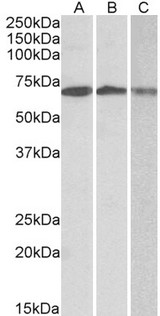 OAS2 Antibody - OAS2 antibody (0.3 ug/ml) staining of Daudi (A), Jurkat (B) and K562 (C) lysates (35 ug protein in RIPA buffer). Primary incubation was 1 hour. Detected by chemiluminescence.