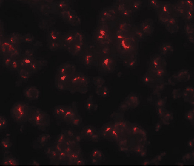 OCIAD1 Antibody - Immunofluorescence of OCIAD1 in 293 cells with OCIAD1 antibody at 20 ug/ml.