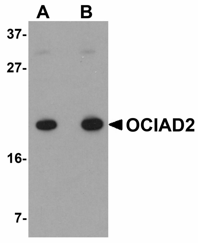 OCIAD2 Antibody - Western blot of OCIAD2 in A549 cell lysate with OCIAD2 antibody at (A) 0.5 and (B) 1 ug/ml. 