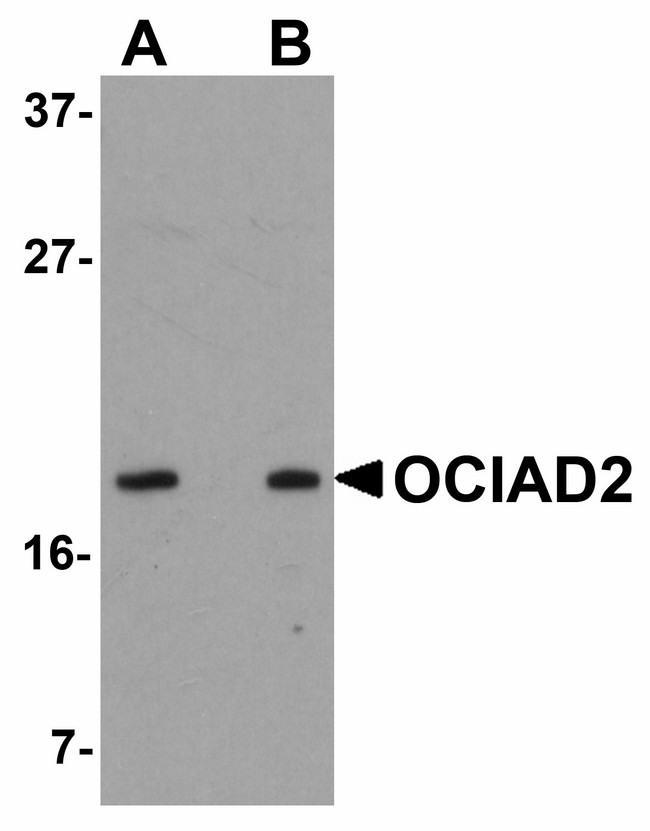 OCIAD2 Antibody - Western blot of OCIAD2 in SK-N-SH cell lysate with OCIAD2 antibody at (A) 0.5 and (B) 1 ug/ml. 