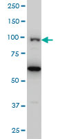 OCRL Antibody - OCRL monoclonal antibody, Western blot of OCRL expression in HeLa NE.