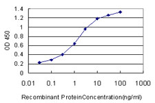 OCRL Antibody - Detection limit for recombinant GST tagged OCRL is approximately 0.1 ng/ml as a capture antibody.