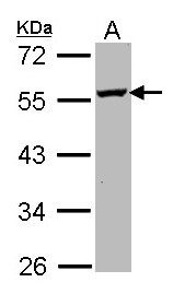 ODC1 / Ornithine Decarboxylase Antibody - Sample (30 ug of whole cell lysate). A: Molt-4 . 10% SDS PAGE. ODC1 / ODC antibody diluted at 1:1000.