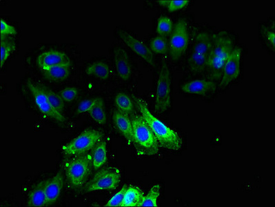 ODC1 / Ornithine Decarboxylase Antibody - Immunofluorescent analysis of HepG2 cells using ODC1 Antibody at dilution of 1:100 and Alexa Fluor 488-congugated AffiniPure Goat Anti-Rabbit IgG(H+L)