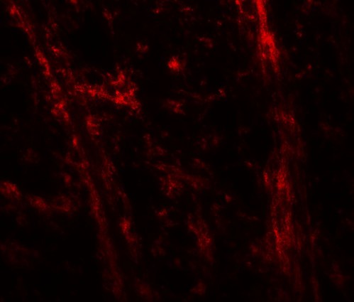 ODZ3 Antibody - Immunofluorescence of TENM3 in mouse brain tissue with TENM3 antibody at 20 ug/mL.