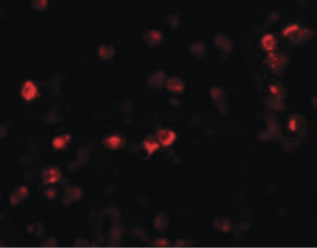 OGFOD1 Antibody - Immunofluorescence of OGFOD1 in Daudi cells with OGFOD1 antibody at 20 ug/ml.