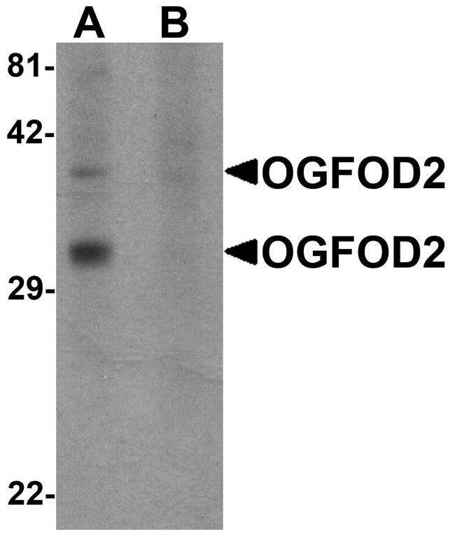 OGFOD2 Antibody - Western blot analysis of OGFOD2 in 293 cell lysate with OGFOD2 antibody at 1 ug/ml in (A) the absence and (B) the presence of blocking peptide.