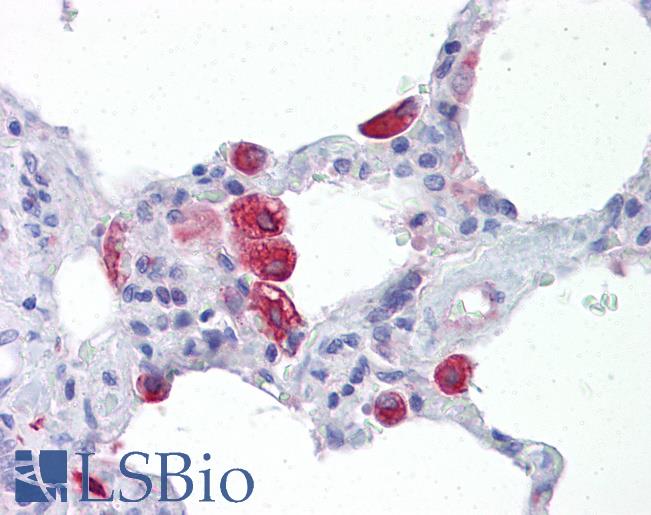 OGFOD2 Antibody - Anti-OGFOD2 antibody IHC of human lung. Immunohistochemistry of formalin-fixed, paraffin-embedded tissue after heat-induced antigen retrieval. Antibody concentration 5 ug/ml.