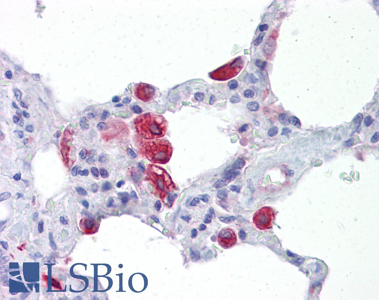 OGFOD2 Antibody - Anti-OGFOD2 antibody IHC of human lung. Immunohistochemistry of formalin-fixed, paraffin-embedded tissue after heat-induced antigen retrieval. Antibody concentration 5 ug/ml.