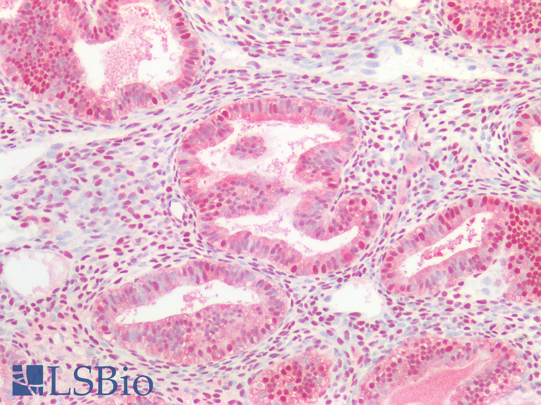 OGG1 Antibody - Human Uterus: Formalin-Fixed, Paraffin-Embedded (FFPE)