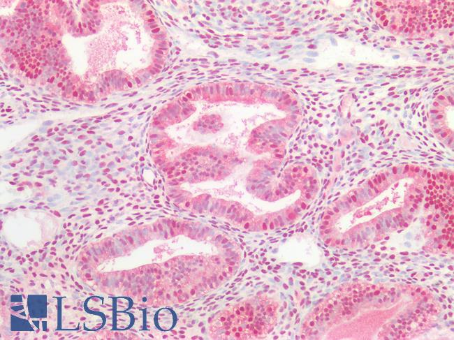 OGG1 Antibody - Human Uterus: Formalin-Fixed, Paraffin-Embedded (FFPE)