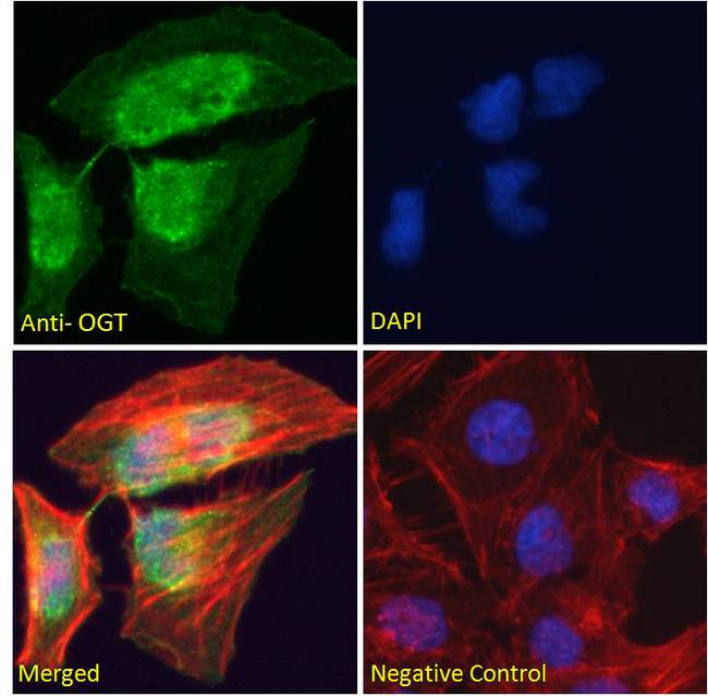 OGT / O-GLCNAC Antibody - OGT / O-GLCNAC antibody immunofluorescence analysis of paraformaldehyde fixed HeLa cells, permeabilized with 0.15% Triton. Primary incubation 1hr (10ug/ml) followed by Alexa Fluor 488 secondary antibody (2ug/ml), showing nuclear staining. Actin filaments were stained with phalloidin (red) and The nuclear stain is DAPI (blue). Negative control: Unimmunized goat IgG (10ug/ml) followed by Alexa Fluor 488 secondary antibody (2ug/ml).
