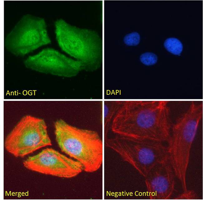 OGT / O-GLCNAC Antibody - OGT / O-GLCNAC antibody immunofluorescence analysis of paraformaldehyde fixed U2OS cells, permeabilized with 0.15% Triton. Primary incubation 1hr (10ug/ml) followed by Alexa Fluor 488 secondary antibody (2ug/ml), showing nuclear and membrane/cytoplasmic staining. Actin filaments were stained with phalloidin (red) and the nuclear stain is DAPI (blue). Negative control: Unimmunized goat IgG (10ug/ml) followed by Alexa Fluor 488 secondary antibody (2ug/ml).