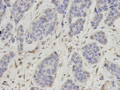OGT / O-GLCNAC Antibody - Immunohistochemistry of paraffin-embedded rat lung using OGT antibody at dilution of 1:100 (400x lens).