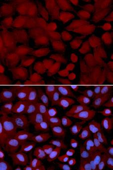 OGT / O-GLCNAC Antibody - Immunofluorescence analysis of U2OS cell using OGT antibody. Blue: DAPI for nuclear staining.
