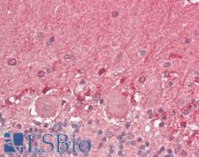 OGT / O-GLCNAC Antibody - Human Brain, Cerebellum: Formalin-Fixed, Paraffin-Embedded (FFPE)
