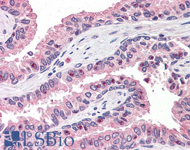 OLFM4 / Olfactomedin 4 Antibody - Anti-OLFM4 antibody IHC of human prostate. Immunohistochemistry of formalin-fixed, paraffin-embedded tissue after heat-induced antigen retrieval.