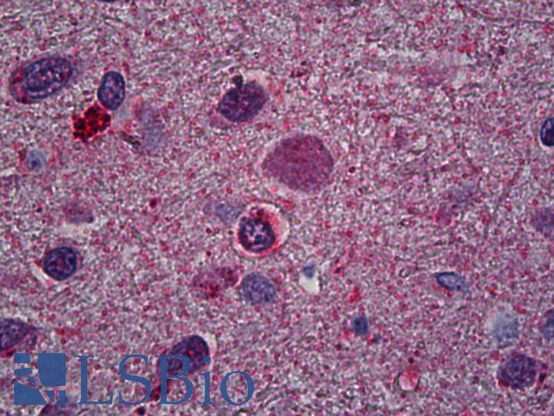 OLIG2 Antibody - Anti-OLIG2 antibody IHC of human brain, oligodendroglia. Immunohistochemistry of formalin-fixed, paraffin-embedded tissue after heat-induced antigen retrieval. Antibody concentration 5 ug/ml.