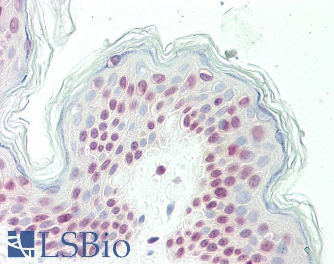 OLIG3 Antibody - Human Skin: Formalin-Fixed, Paraffin-Embedded (FFPE)