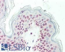 OLIG3 Antibody - Human Skin: Formalin-Fixed, Paraffin-Embedded (FFPE)