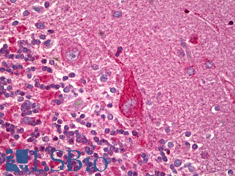 OPA1 Antibody - Anti-OPA1 antibody IHC of human brain, cerebellum, Purkinje cells. Immunohistochemistry of formalin-fixed, paraffin-embedded tissue after heat-induced antigen retrieval. Antibody dilution 1:100.  This image was taken for the unconjugated form of this product. Other forms have not been tested.