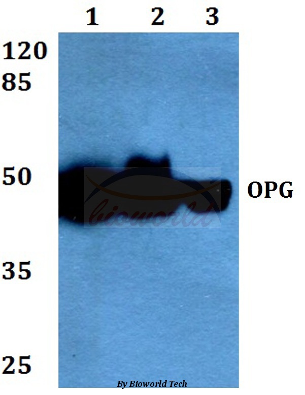 OPG / Osteoprotegerin Antibody - Western blot analysis of OPG (P25) pAb at a 1:500 dilution. Lane 1: HEK293T whole cell lysate. Lane 2: Raw264.7 whole cell lysate. Lane 3: H9C2 whole cell lysate.
