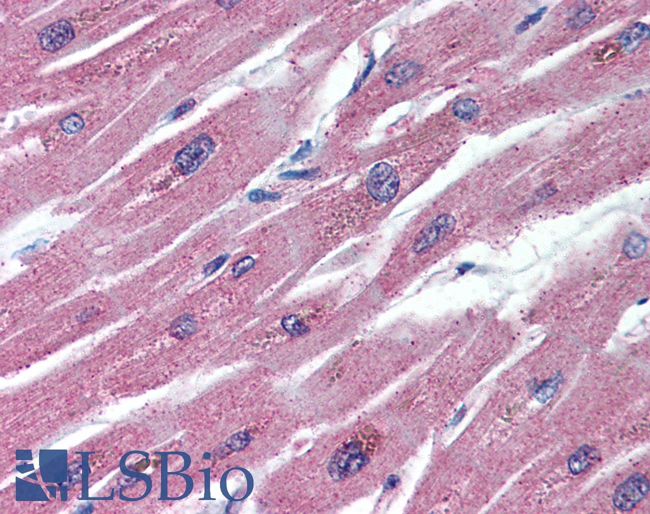 OPG / Osteoprotegerin Antibody - Anti-Osteoprotegerin antibody IHC of human heart. Immunohistochemistry of formalin-fixed, paraffin-embedded tissue after heat-induced antigen retrieval. Antibody concentration 5 ug/ml.