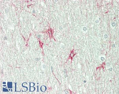 OPN5 / Neuropsin Antibody - Human Brain, Cerebellum, White Matter: Formalin-Fixed, Paraffin-Embedded (FFPE)
