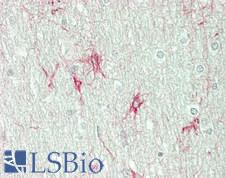 OPN5 / Neuropsin Antibody - Human Brain, Cerebellum, White Matter: Formalin-Fixed, Paraffin-Embedded (FFPE)